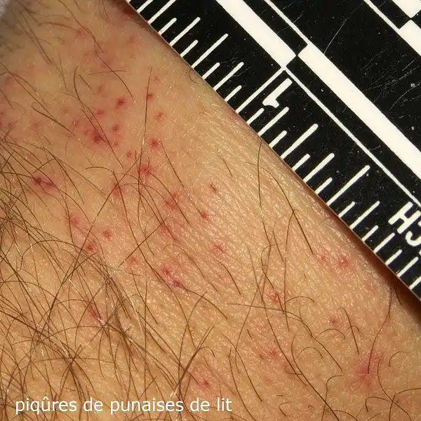 anti piqure punaise lit