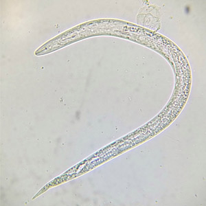 Vue d'un nématode au microscope
